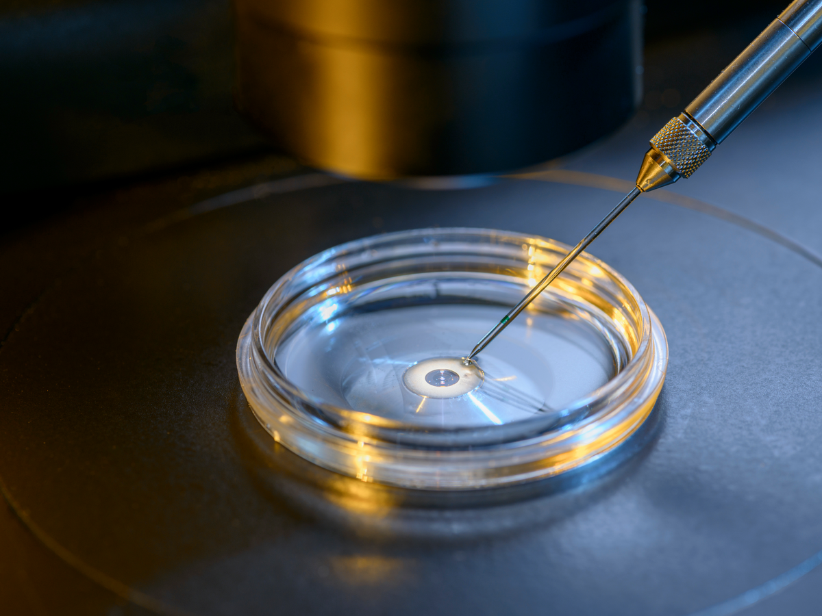 Types of Assisted Reproductive Technologies: Methods and Applications ...